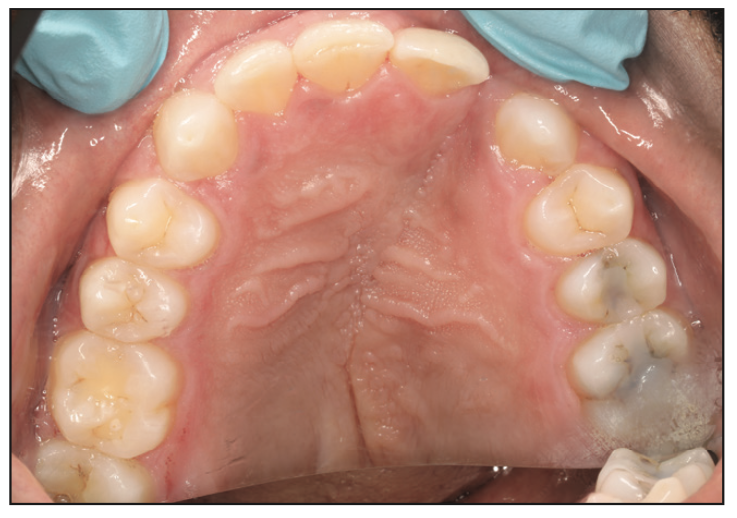 Three-Dimensional Printing in Combined Orthodontic and Restorative Treatment